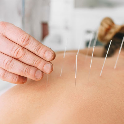 Acupuncturists